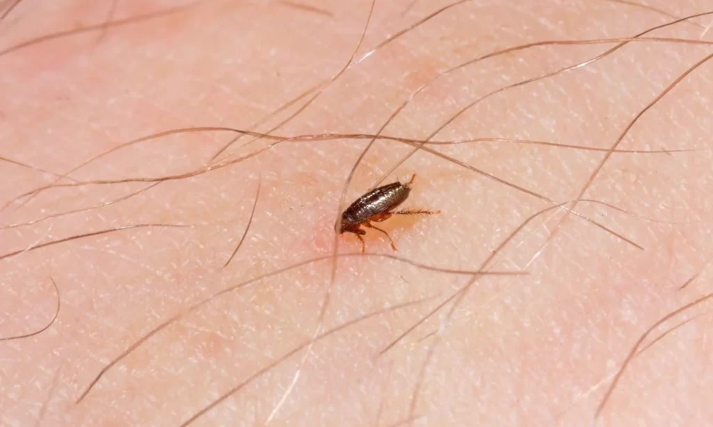 Flea bites human