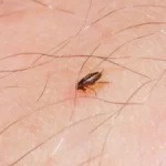 Flea bites human