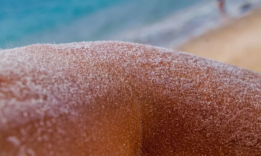 Arm covered by salt after bathing