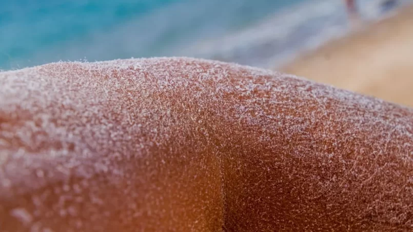 Arm covered by salt after bathing